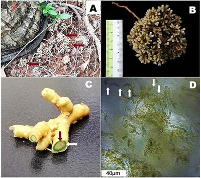 Perspectives on Endosymbiosis in Coralloid Roots: Association of Cycads and Cyanobacteria